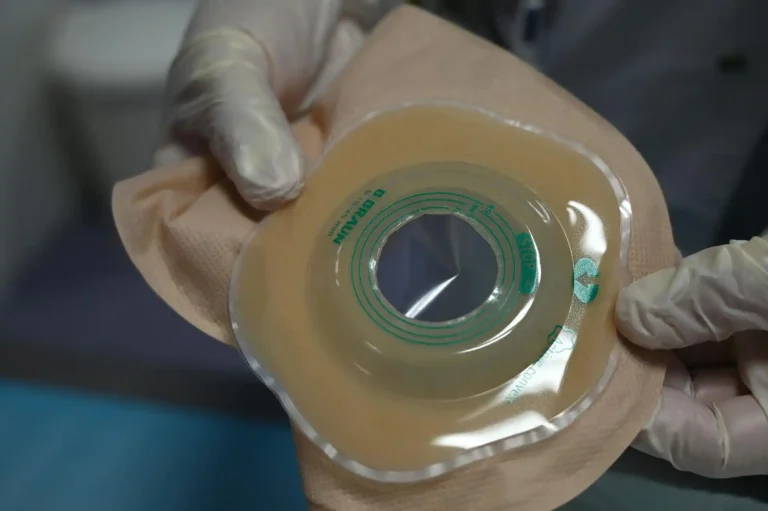 Σακούλα κολοστομίας